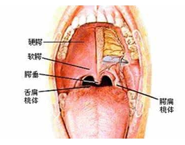 莫让"别人说"害了孩子:扁桃体腺样体手术的误区