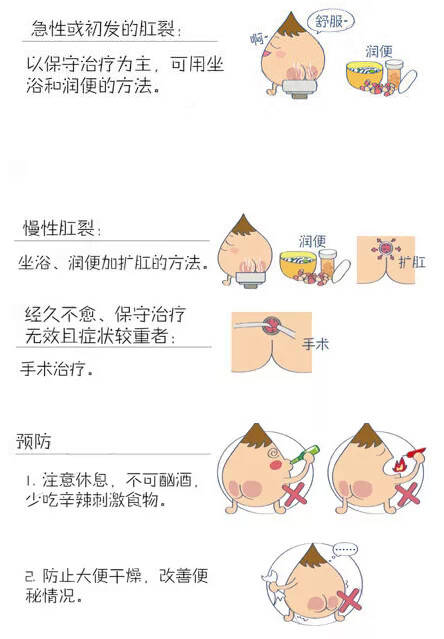 深圳福田肛裂图片