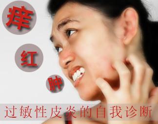 南京过敏性皮炎_家庭医生在线官网网站