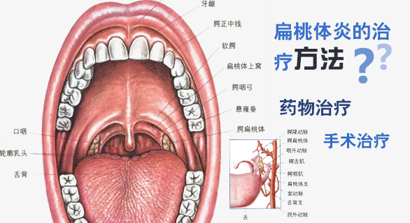 扁桃体切除能报销学生险吗 学平险可以报销孩子扁桃体手术吗